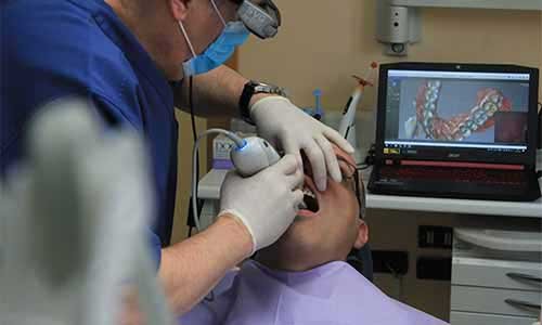 Dental Implants